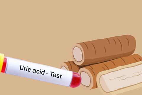 Ngăn ngừa axit uric tăng vọt chỉ bằng 1 loại rễ cây quen thuộc