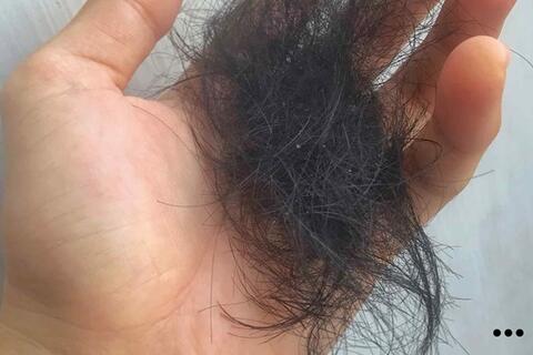 3 thói quen khiến tóc rụng nhiều