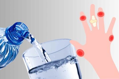 2 cách đơn giản giúp ngăn ngừa bệnh gút