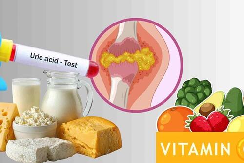 6 thực phẩm giúp chuyển hóa axit uric, giảm sự khó chịu do bệnh gút