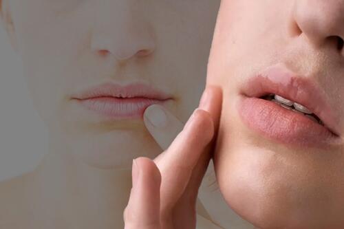 Liếm môi vào mùa đông khiến môi khô và nứt nẻ nghiêm trọng hơn