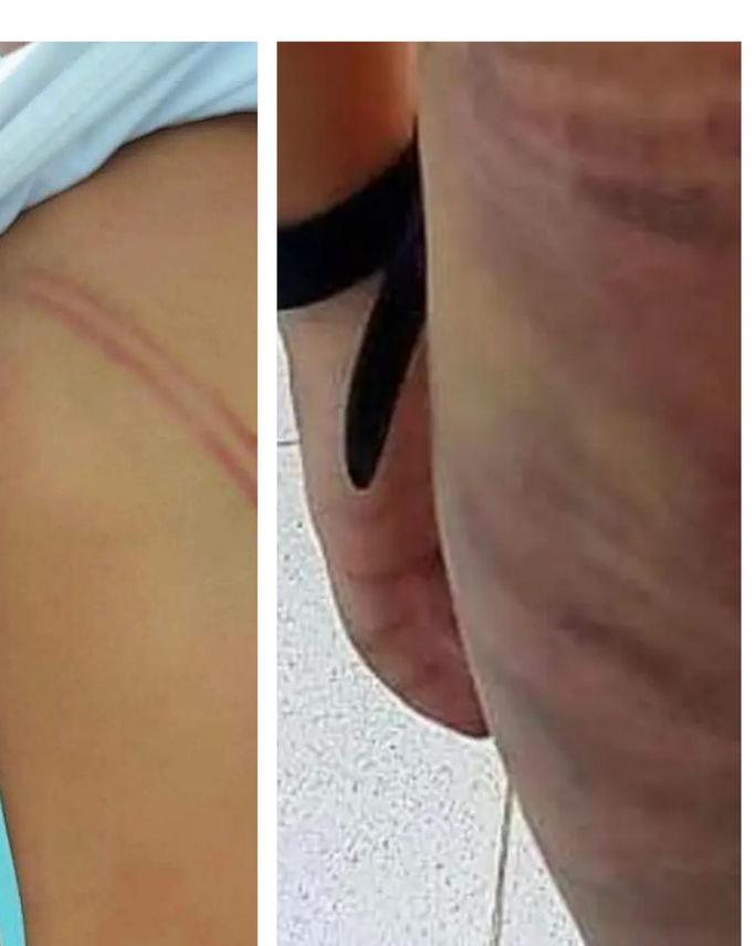 Xã hội - Chủ tịch tỉnh Cà Mau chỉ đạo “nóng” vụ mẹ kế đánh con chồng bầm tím khắp người