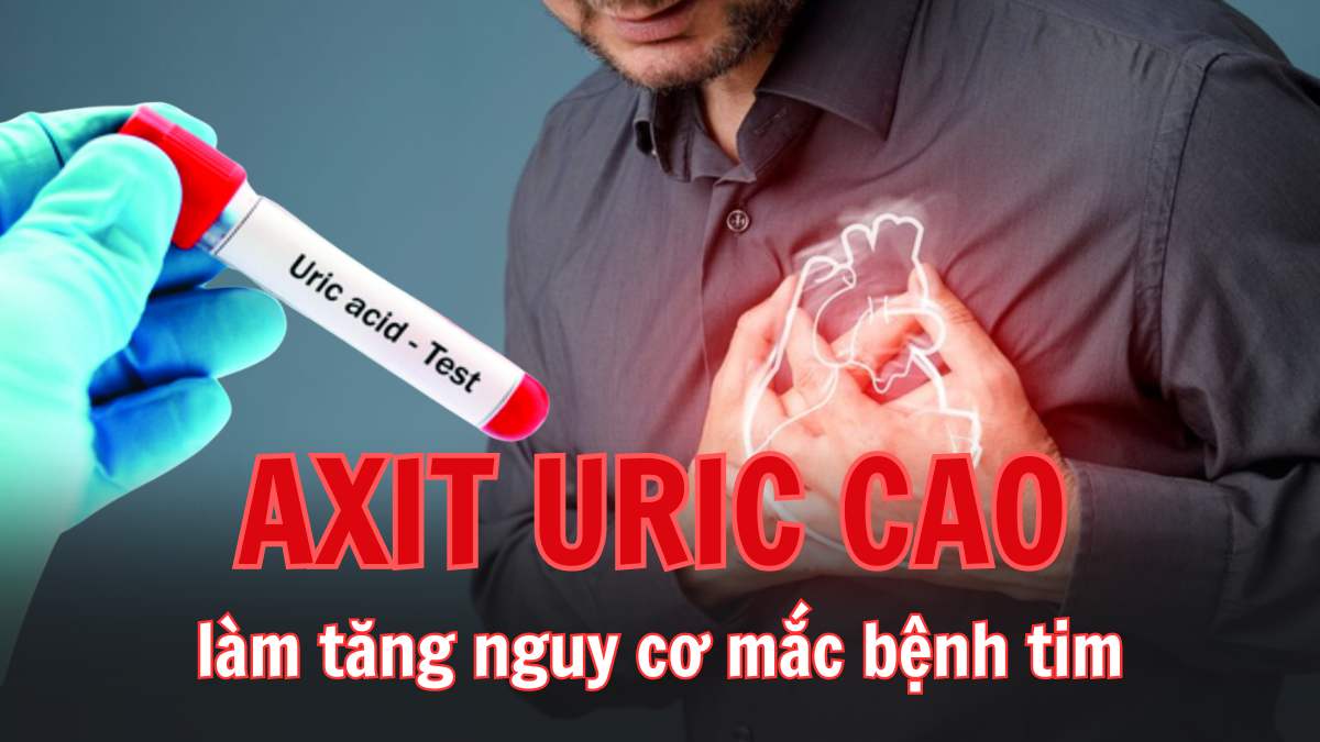 Axit uric cao làm tăng nguy cơ mắc các bệnh tim mạch. Đồ họa: Thùy Dung