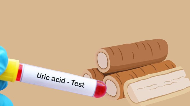 Ngăn ngừa axit uric tăng vọt chỉ bằng 1 loại rễ cây quen thuộc